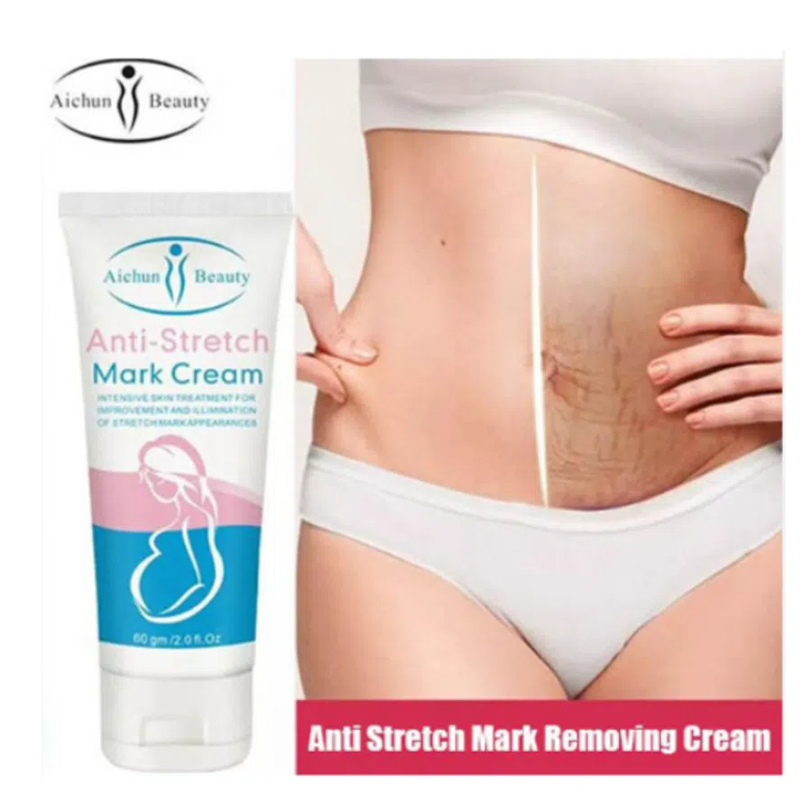 Anti Stretch Mark Cream Aichun Beauty