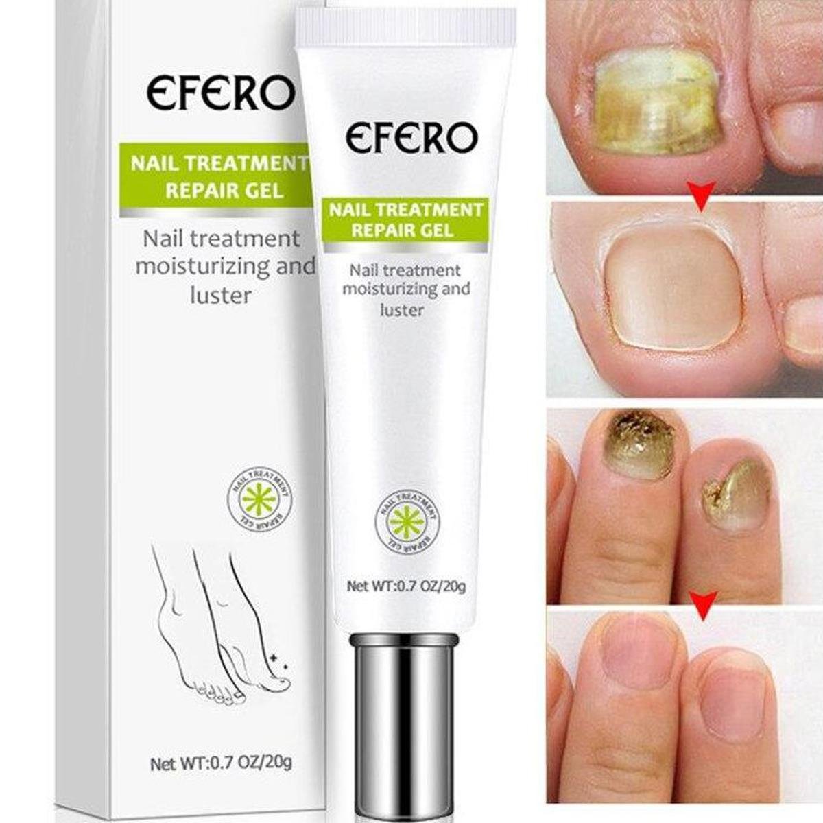 Nail Repair And Fungus Treatment Solution